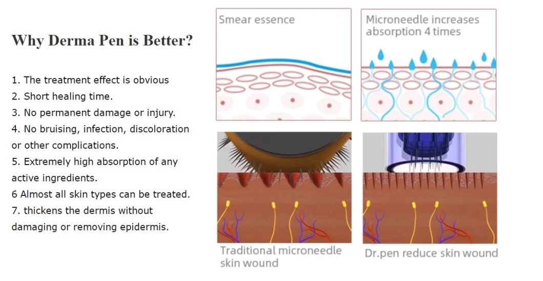 Best Electronic Replaceable Dermapen Microneedling Ultima A1 Dr. Pen with OEM Available