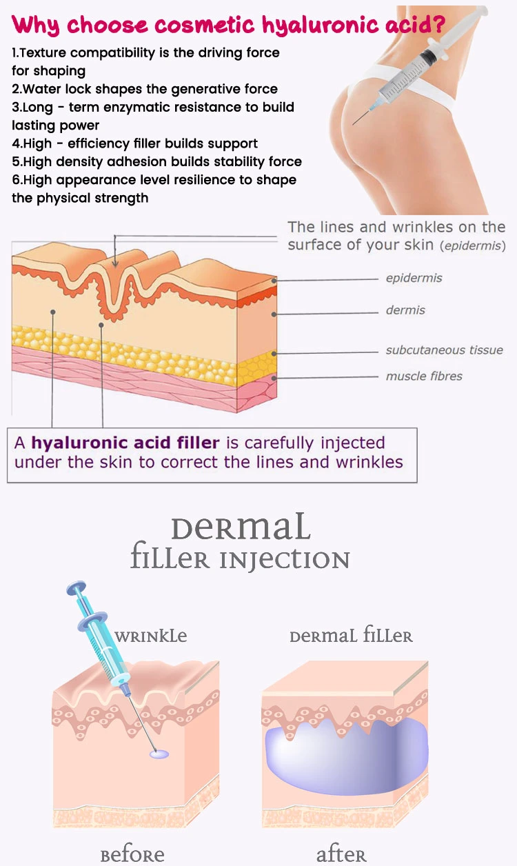 Factory Supply Acid Hyaluronic 10ml Dermal Filler Injection for Buttocks/Breast